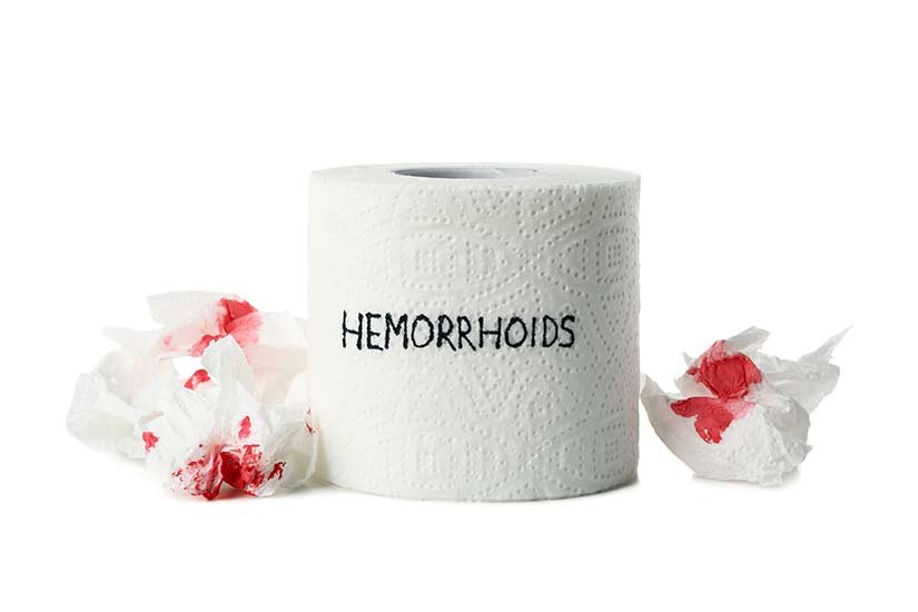 Natural Remedies for hemorrhoids
