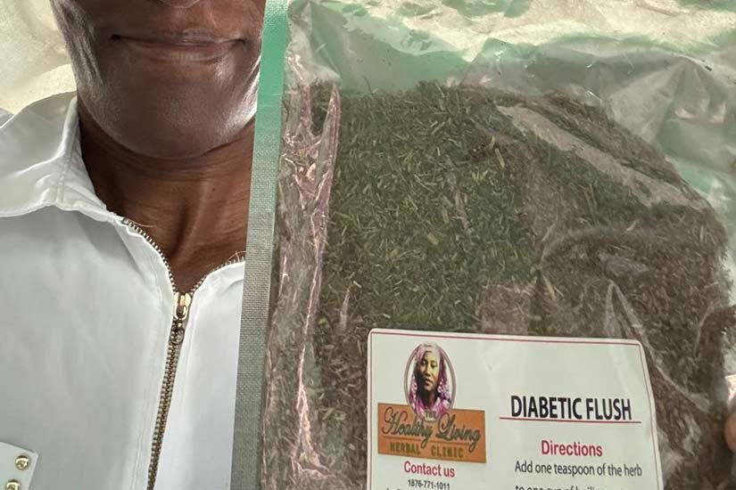 Smiling young woman with acne, wearing a white t-shirt.